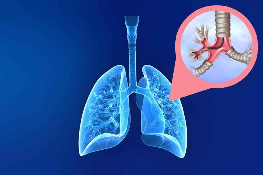 Göğüs hastalıkları tanısal işlemlerinde devrim: EBUS (Endobronşial Ultrasonografi)